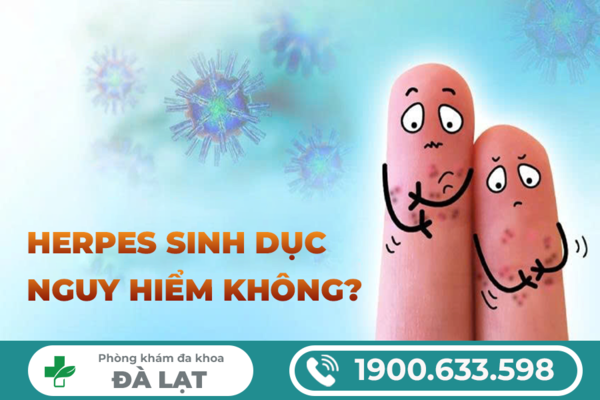 Hình ảnh minh họa